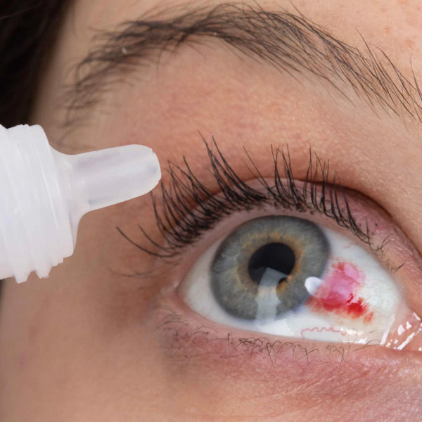 Gotas de Miel para Ojos